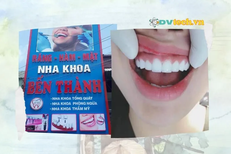 Nha khoa Bến Thành